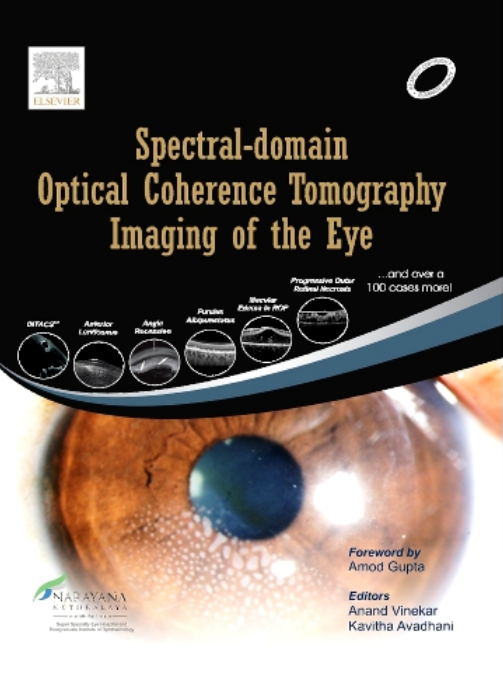 Spectral-domain Optical Coherence Tomography Imaging of the Eye